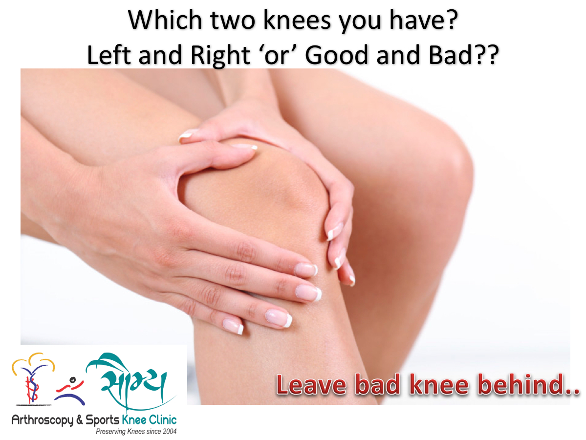 Good Knee or Bad Knee