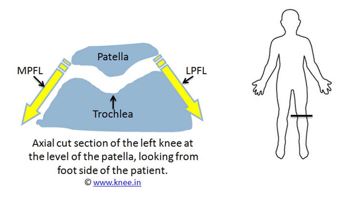 Normal relation between patella, trochlea and its ligaments by Deepak Goyal